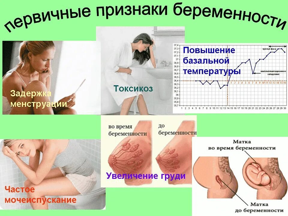 Токсикоз после зачатия