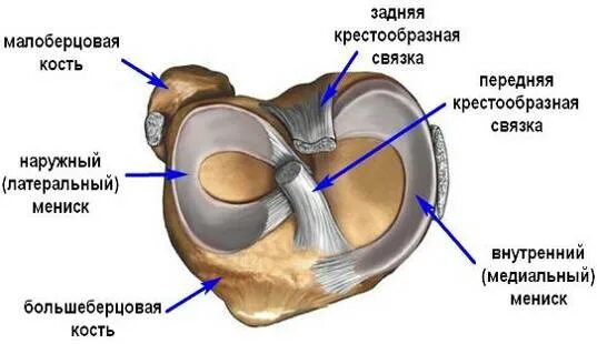 Медиальный Рог медиального мениска. Задний Рог медиального мениска. Разрыв рога медиального мениска коленного сустава. Дистрофические изменения заднего рога мениска
