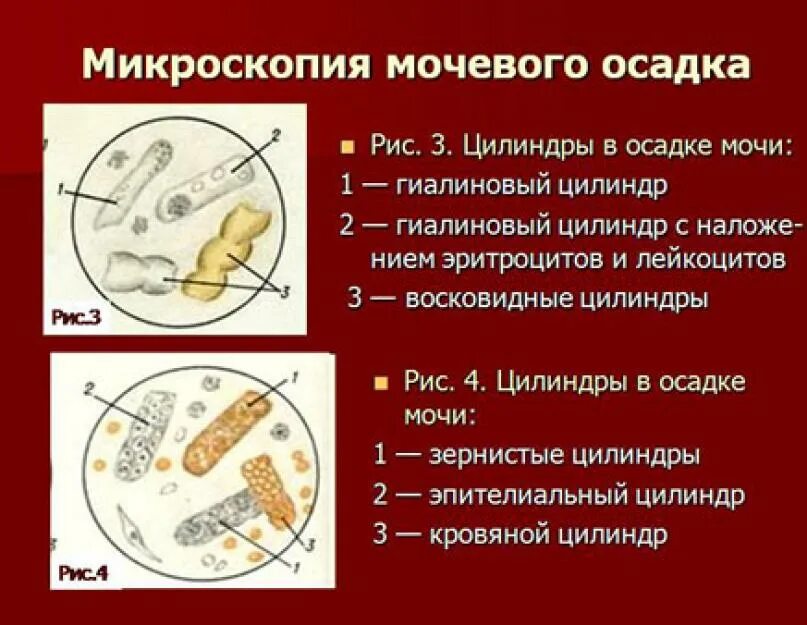 Моче слизь эритроциты