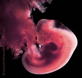 4 6 weeks