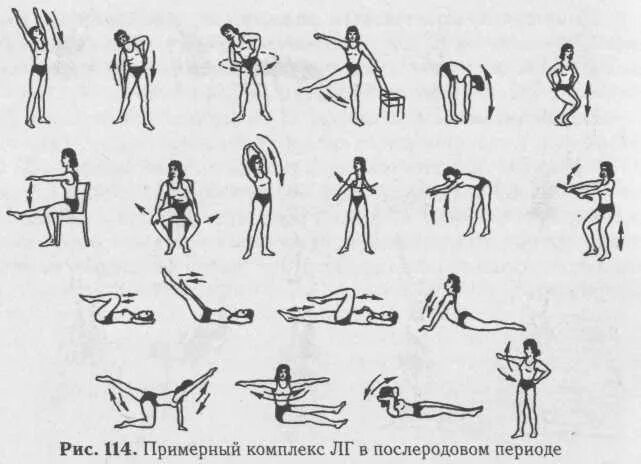 Какие упражнения нужно делать после инсульта. Гимнастика после инсульта комплекс упражнений. инсульт лфк комплекс. лечебная физкультура после инсульта комплекс упражнений. примерный комплекс лг при пояснично крестцовом радикулите.