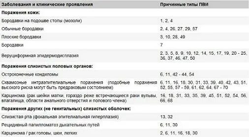 Папиллома код по мкб