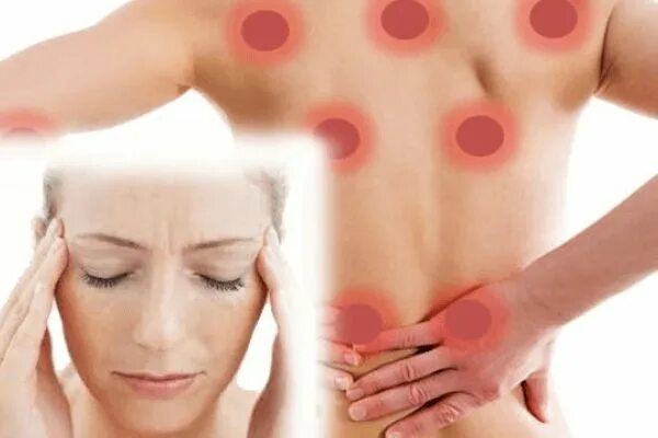 Treatment of Fibromyalgia Syndrome with Traditional Chinese Medicine WeFine Heal