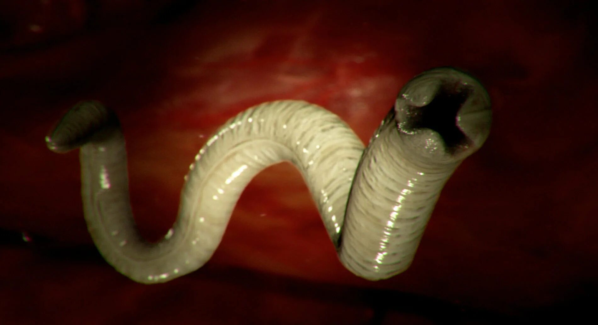 Силитер. Аскарида желудочный червь. Гельминты паразитические черви.