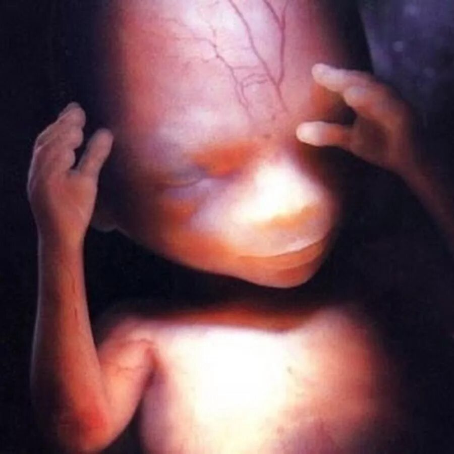 Показатели хгч по неделям беременности. Животик на 30 неделе беременности. Ребёнок в утробе матери фото. Эмбрион на 3 4 недели беременности фото. Узи детей в животе.