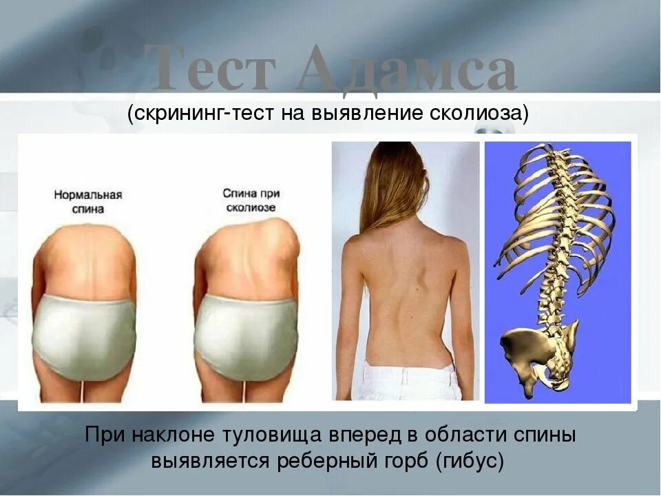 Горбы несущие