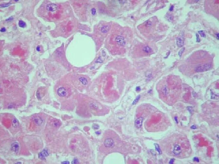 мезенхимальные жировые дистрофии. костные дистрофии. костные дистрофии. костные дистрофии. костные дистрофии.