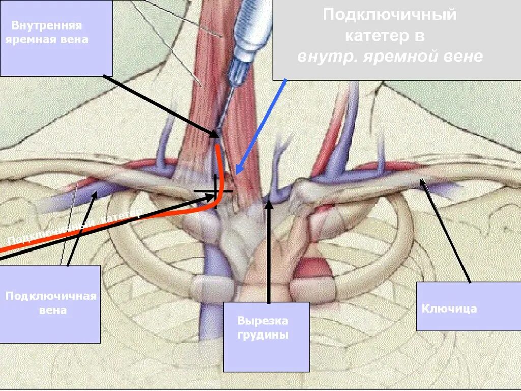 Правая подключичная вена. Подключичная Вена (Vena subclavia). Подключичная Вена анатомия схема. Подключичная пункция подключичной вены. Подключичная Вена топография.