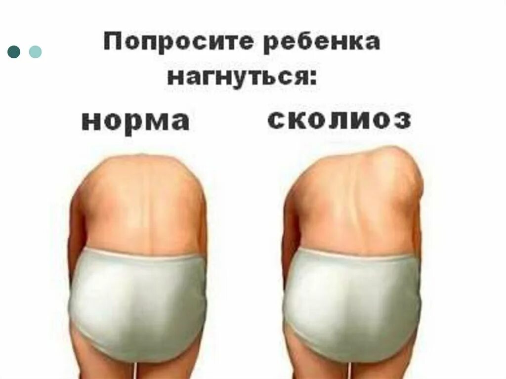 Горбы несущие