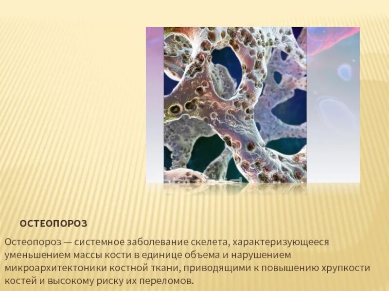 Системное заболевание скелета
