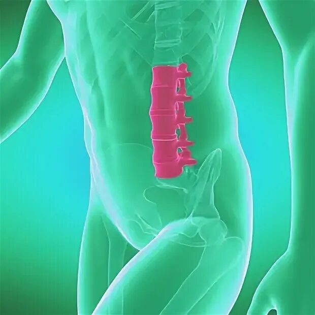 Yoga & Spinal Fusion Livestrong.com Spinal fusion surgery, Spinal fusion, Spinal
