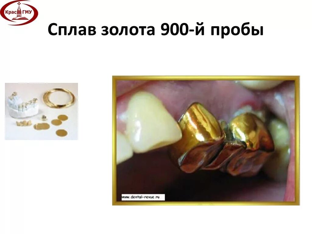 Сплав золота 900 пробы в стоматологии. Сплав золота сплав 750 пробы,. Золото 900 пробы коронка. Сплав золота 900 пробы (диски),.