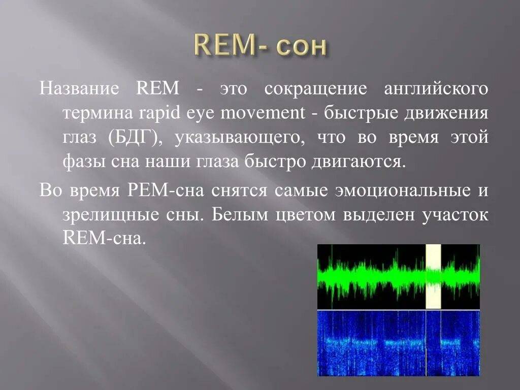 Стадия быстрого сна. Фаза быстрого движения глаз. Быстрое движение глаз во время сна. Движения глаз во время сна. Движение глаз во сне.