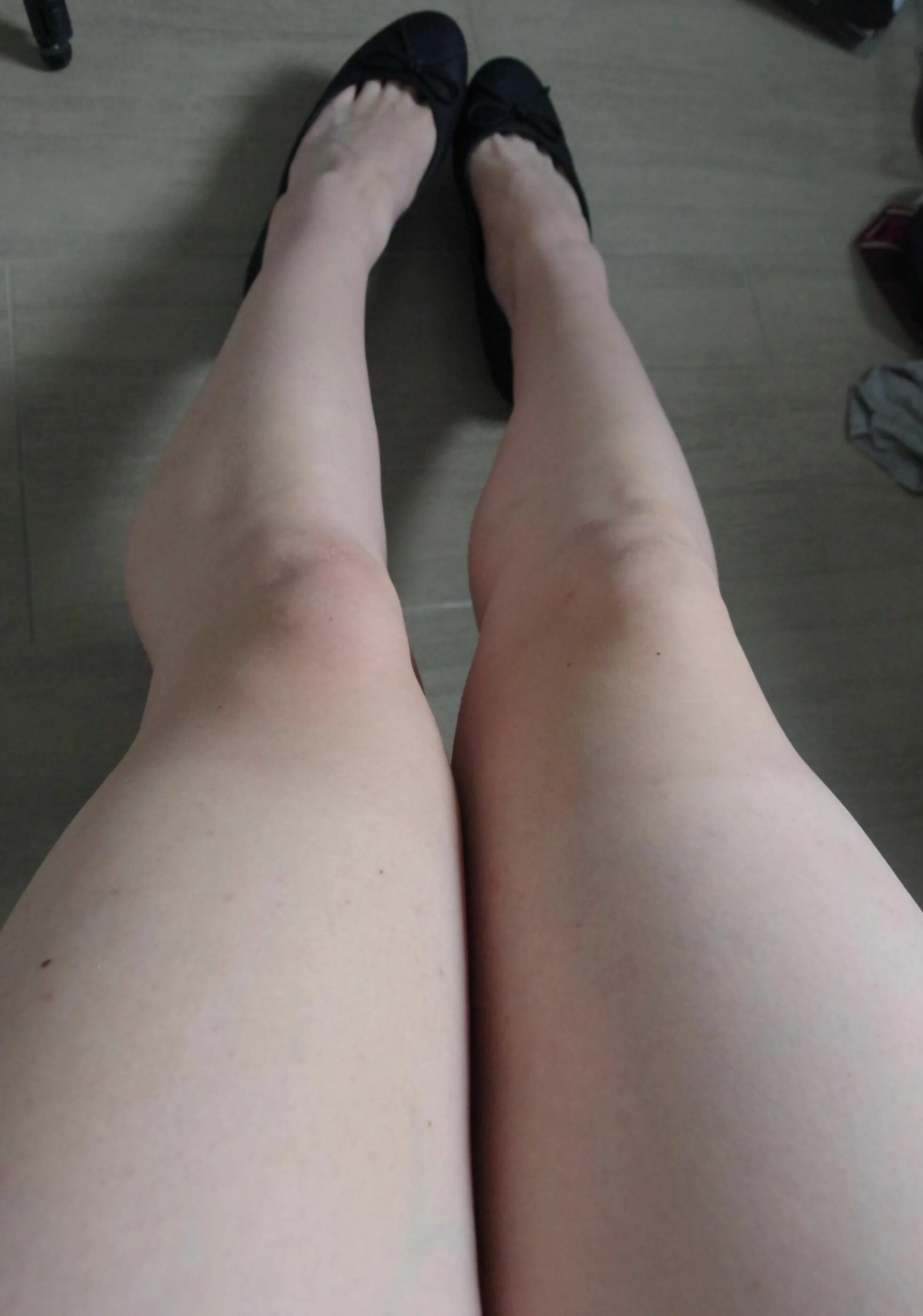 Бледные ноги. Бледные женские ноги. Бледные ножки девушки. Холодные бледные ноги