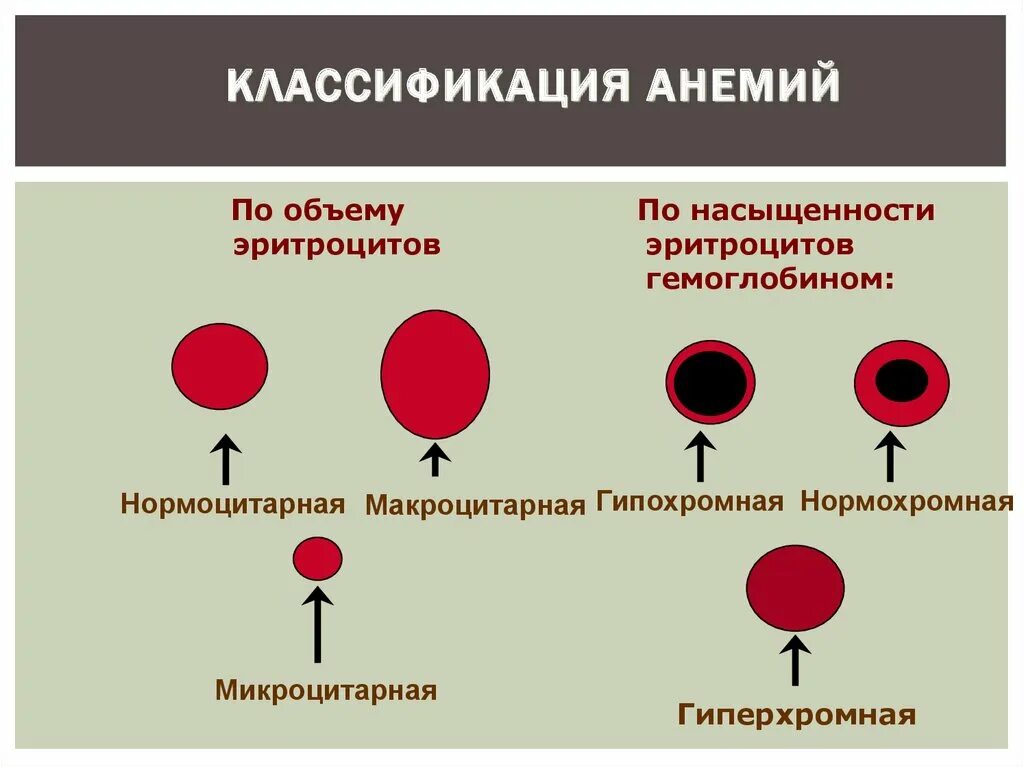 Классификация анемий. Классификация эритроцитов. Классификация анемий по форме эритроцитов. Классификация анемий по эритроцитам.