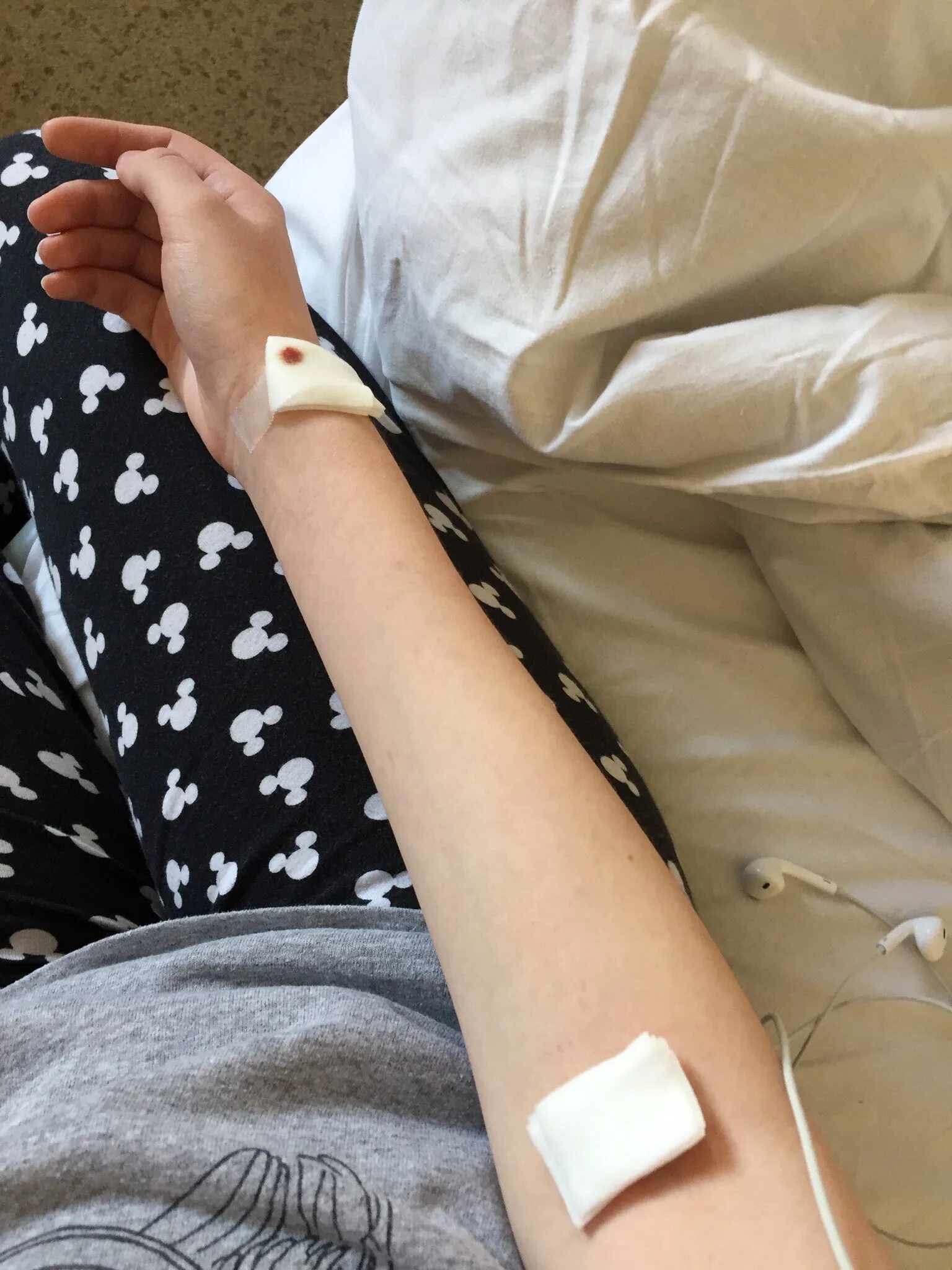 Как выглядит рука после капельницы Patient hand with an intravenous drip. Patient's hand with an intravenous drip b