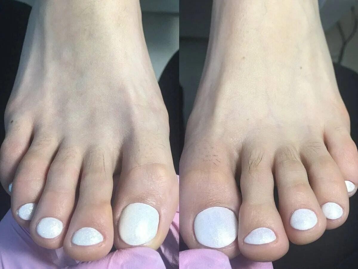 Педикюр наращивание ногтей на ногах. Красивый однотонный педикюр. Овальные ноги. Красивый педикюр. Красивые женские ноги.