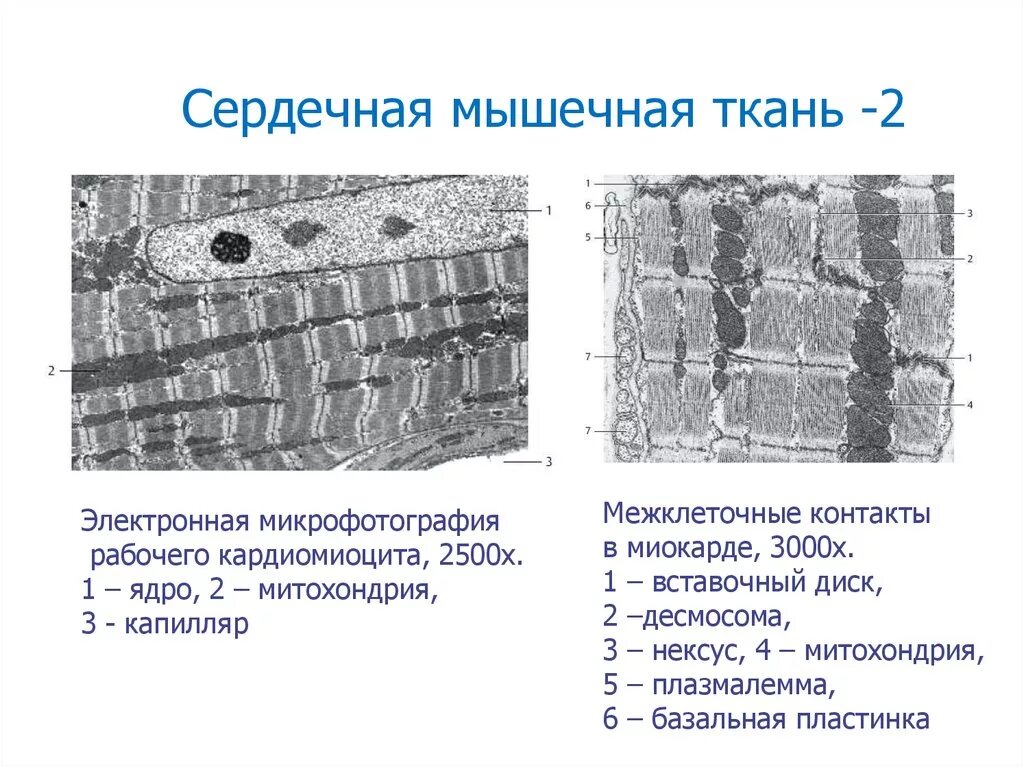 Состоит из клеток имеющих поперечную исчерченность. Сердечная мышечная ткань вставочный диск. Сердечная мышечная ткань Электронограмма. Сердечная мышечная ткань вставочные диски Электронограмма. Поперечно полосатая сердечная мышечная ткань препарат миокарда.