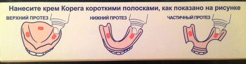 Как правильно наносить корегу на протез. Корега для зубных протезов. Нанесение Корега на протез. Протезы для зубов на Кореге. Клей Корега для зубных.