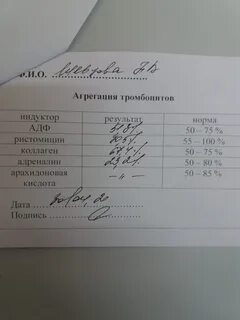 Анализ афс