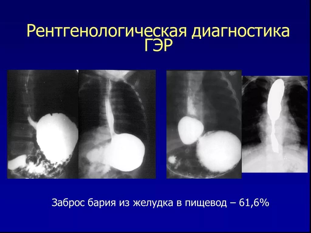 Исследования пищевода и желудка