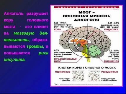 Разрушение мозга