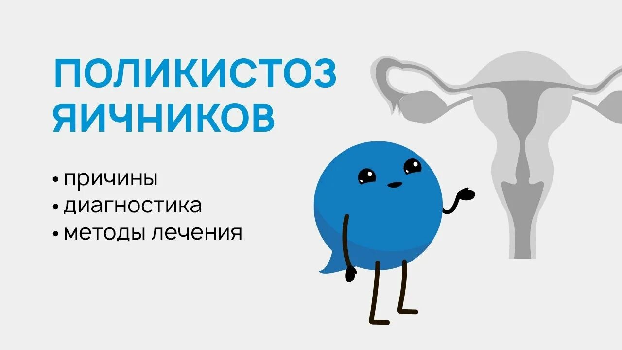 Лечение яичников у девушек. Синдром поликистозных яичников. поликистоз яичников лечение. схема лечения поликистоза яичников.