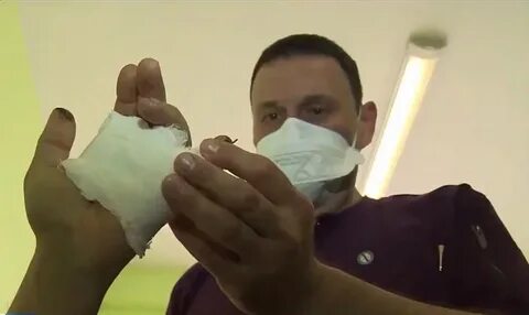 Хирург пришил лицо