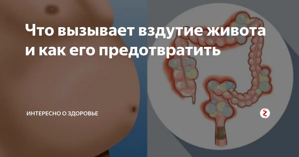 Вздутие живота метеоризм. Вздутие и распирание живота. Почему бывает вздутие живота