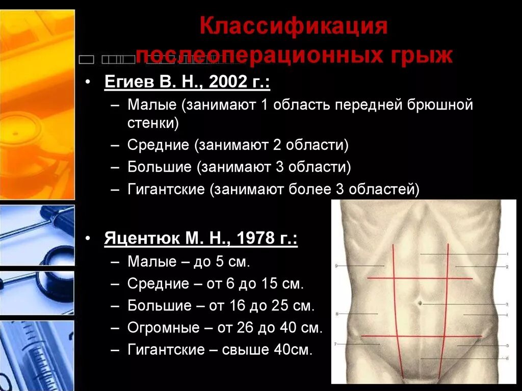 Классификация послеоперационных грыж передней брюшной. Послеоперационная вентральная грыжа классификация MWR. 10. Послеоперационные грыжи передней брюшной стенки.. Классификация размеров грыж передней брюшной стенки.