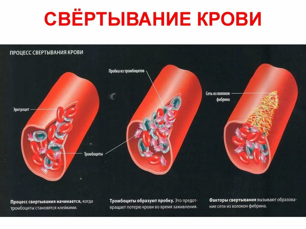 Кис крови. Свёртываемость крови переливание крови группы крови. Нарушение свертывающей системы крови. Процесс свертывания крови. Тромбоциты свертывание крови.