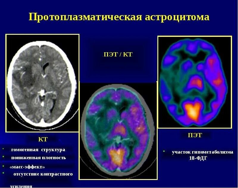 Пт кт