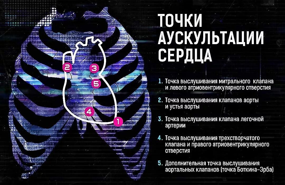Аускультация сердца алгоритм. Аускультация сердца точки выслушивания. аускультация сердца точки алгоритм. точки аускультации сердца 5 точек. точка выслушивания митрального клапана.