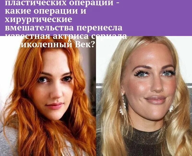 Мерьем узерли до и после похудения Pin by Mia on She Fashion, Meryem uzerli, Striped top