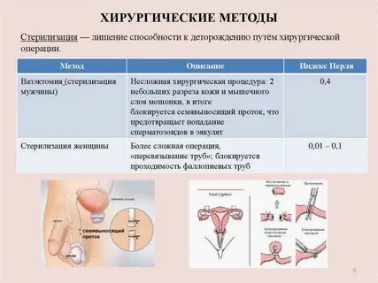 Стерилизация труб можно забеременеть