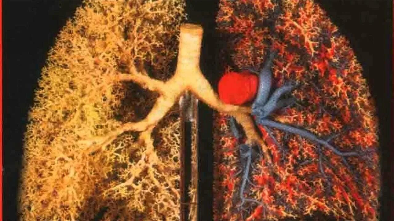 3): Tracheobronchial Tree.(Seeley R.R., Stephens T.D. and Tate P.... Download Sc
