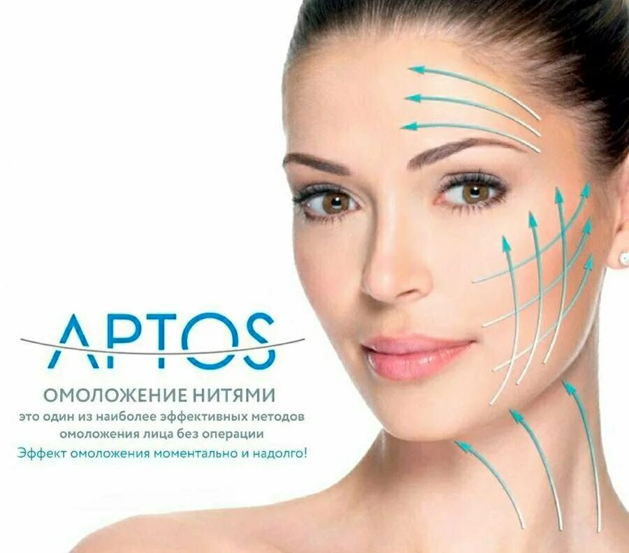 Нити для подтяжки лица как выглядит Collagen Neocollagenesis Pcl Thread W Cannula Buy Collagen Neocollagenesis,W C