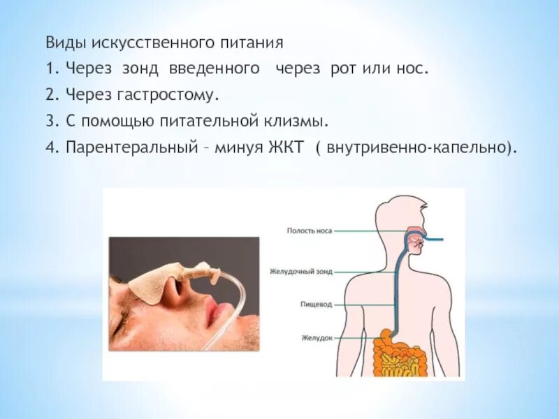 Через рот. Виды искусственного питания. Питание через желудочный зонд. Введение пищи через желудочный зонд. Искусственное питание через зонд.