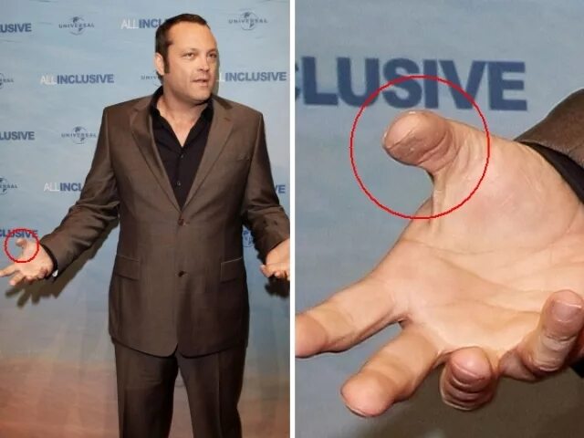 Француз руки. Руки известных людей. Большие пальцы большие у звезд. Актер с дефектом руки.