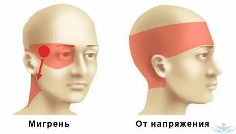 Головная боль правая бровь