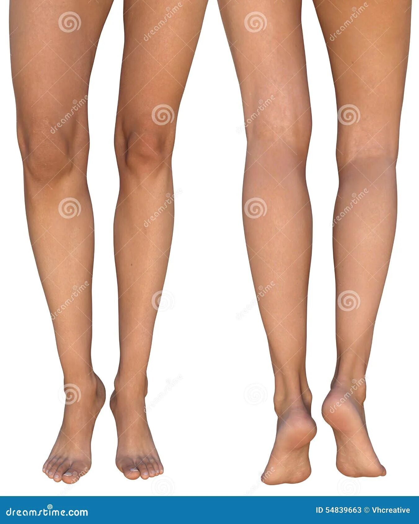Ноги женщин выше колен. Женские ноги стоят. Женские ноги согнутые в коленках. Женские ноги спереди. Красивые коленки.