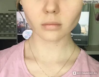 Впала щека что делать