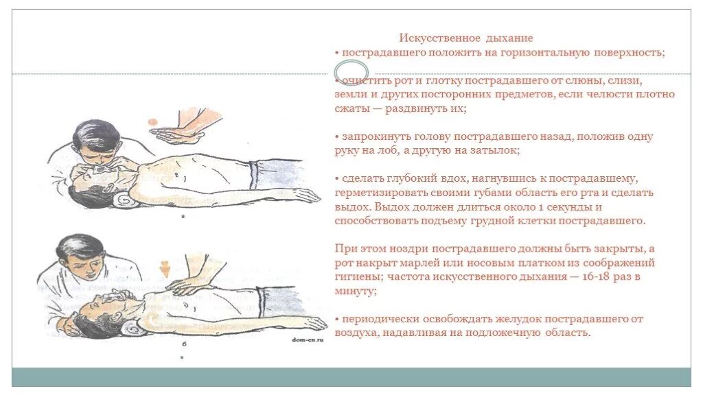 Удаление воздуха из желудка при искусственном дыхании. При выполнении искусственного дыхания для удаления воздуха. Искусственное дыхание при устранении воздуха из желудка. Частота искусственного дыхания.