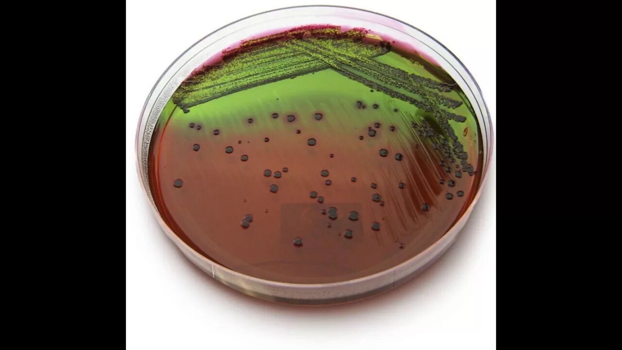 Эндо агар e.coli. Среда висмут сульфит агар. Среды Эндо Левина Плоскирева. Сальмонеллы шигеллы эшерихии. Посев на сальмонеллез