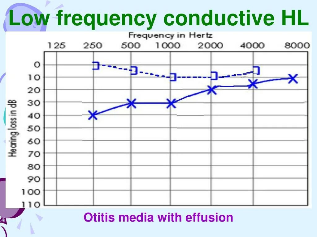 Lower frequency