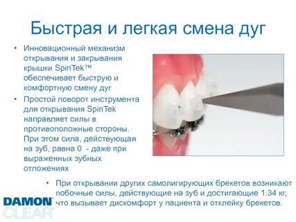 Замена дуги