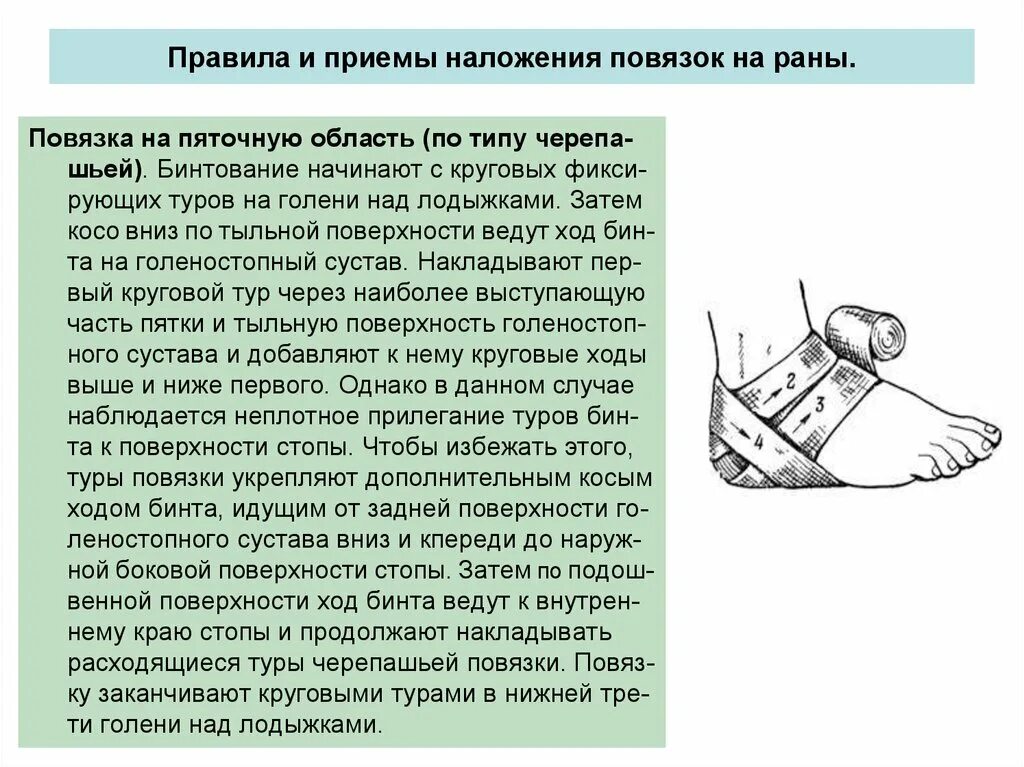 Перевязка чистой раны алгоритм. Наложение повязок на раны. Наложение повязки на пятку. Повязка на пяточную область. Правило наложение повязок на раны.