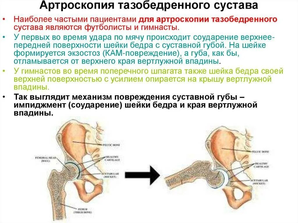 Боль в бедре диагноз. Тазобедренный сустав. Тазобедренный сустав суставы. Строение тазобедренного сустава. Правый тазобедренный сустав.