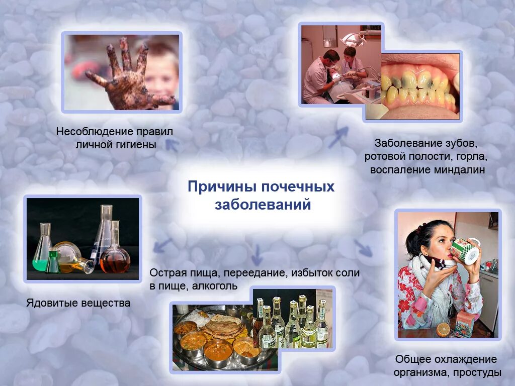 болезни почек биология. теории образования камней при мочекаменной болезни. заболевание почек профилактика 8 класс биология. меры профилактики почечных заболеваний. причины почечных заболеваний.