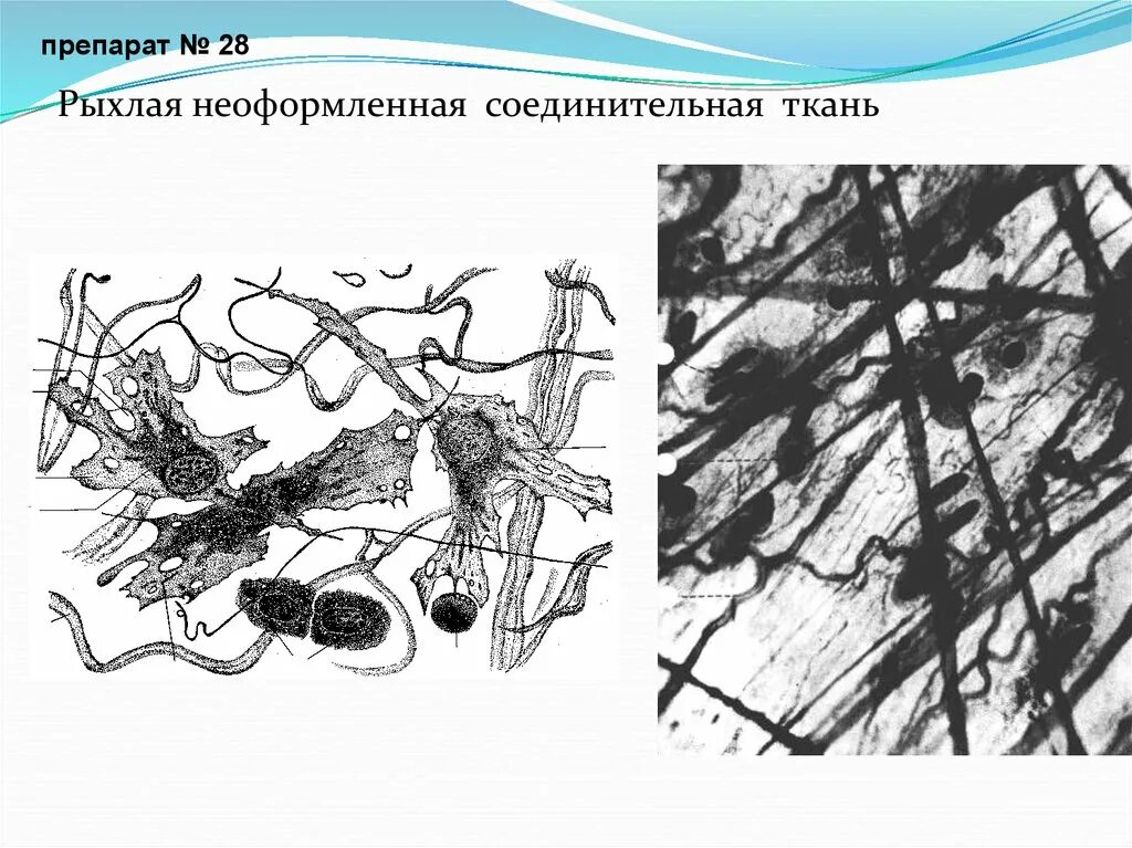 Рыхлая плотная неоформленная соединительная ткань. Соединительная неоформленная соединительная ткань. плотная неоформленная соединительная ткань схема. рыхлая волокнистая неоформленная соединительная. плотная волокнистая неоформленная соединительная ткань схема.